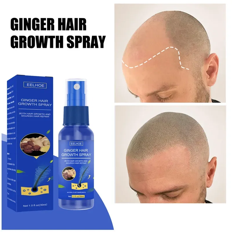 Haargroei Spray Bevorderen Sne - Perfume Zara recensie en prijs